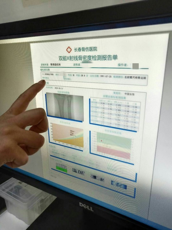 品源雙能X射線骨密度儀落戶吉林省長春骨傷醫(yī)院，助力骨松診療