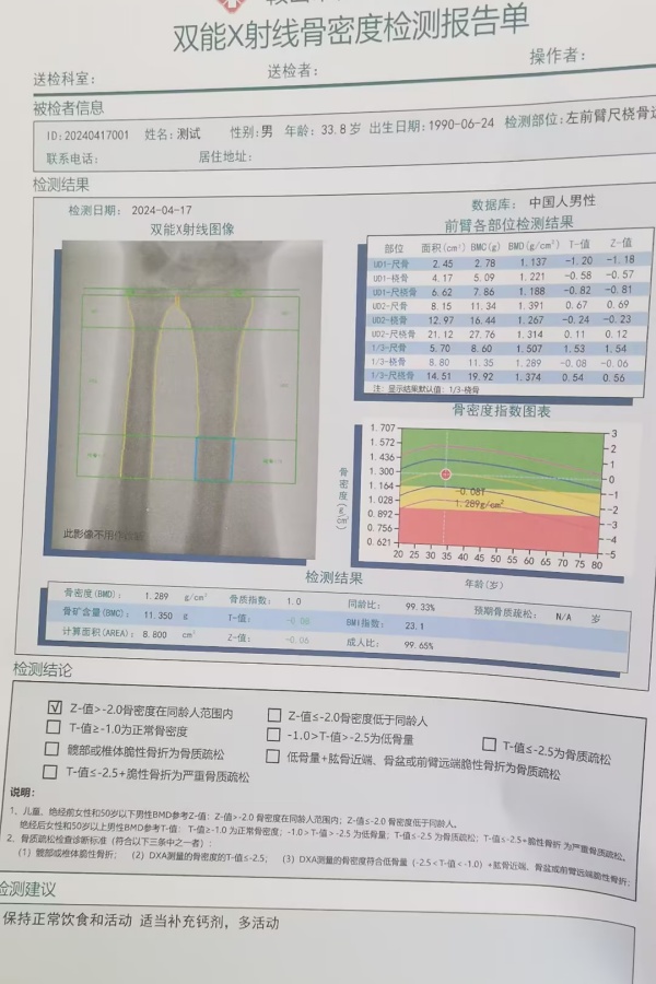 雙能X射線骨密度儀：準(zhǔn)確測(cè)量骨密度，助力骨質(zhì)疏松防治，守護(hù)骨骼健康